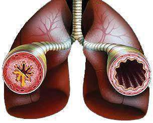 Что происходит в организме во время астмы?