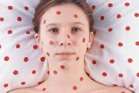 Негормональные уколы т аллергии