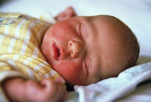 аллергии у новорожденных